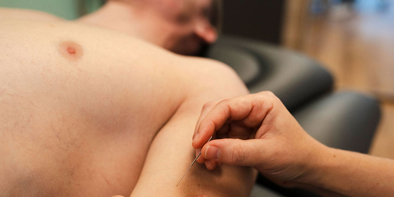 Dry Needling/ Myofasziale Triggerpunkt-Therapie